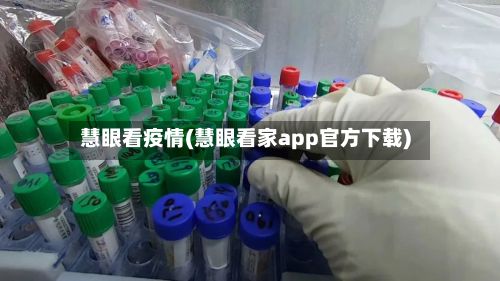 慧眼看疫情(慧眼看家app官方下载)-第2张图片